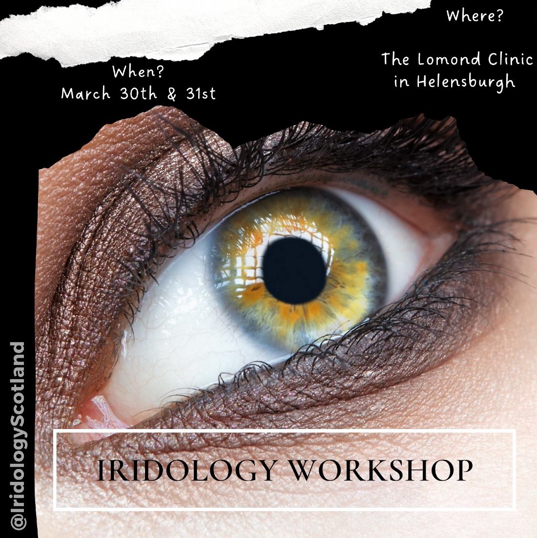 Iridology learn more about this Complementary Medicine, The