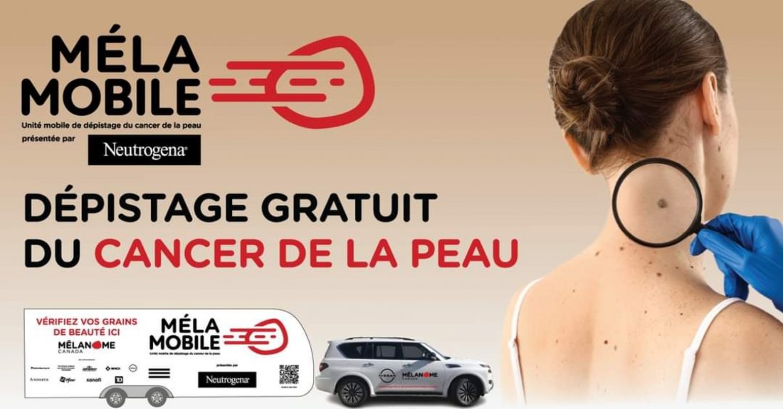 Dépistage gratuit du cancer de la peau à NotreDamedeGrâce, Québec — free download