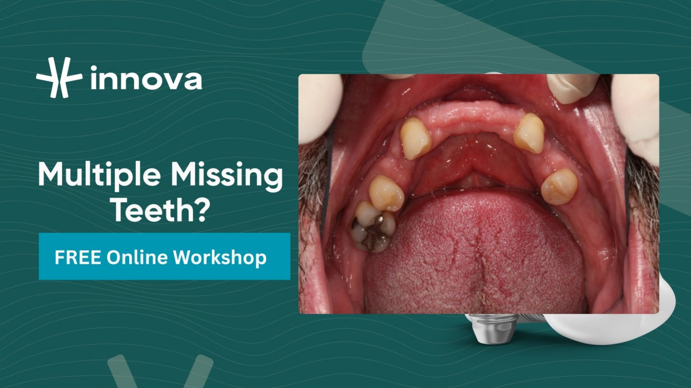 Multiple Missing Teeth? FREE Workshop about Full Mouth Restoration Options in Brunswick, 15 December | AllEvents